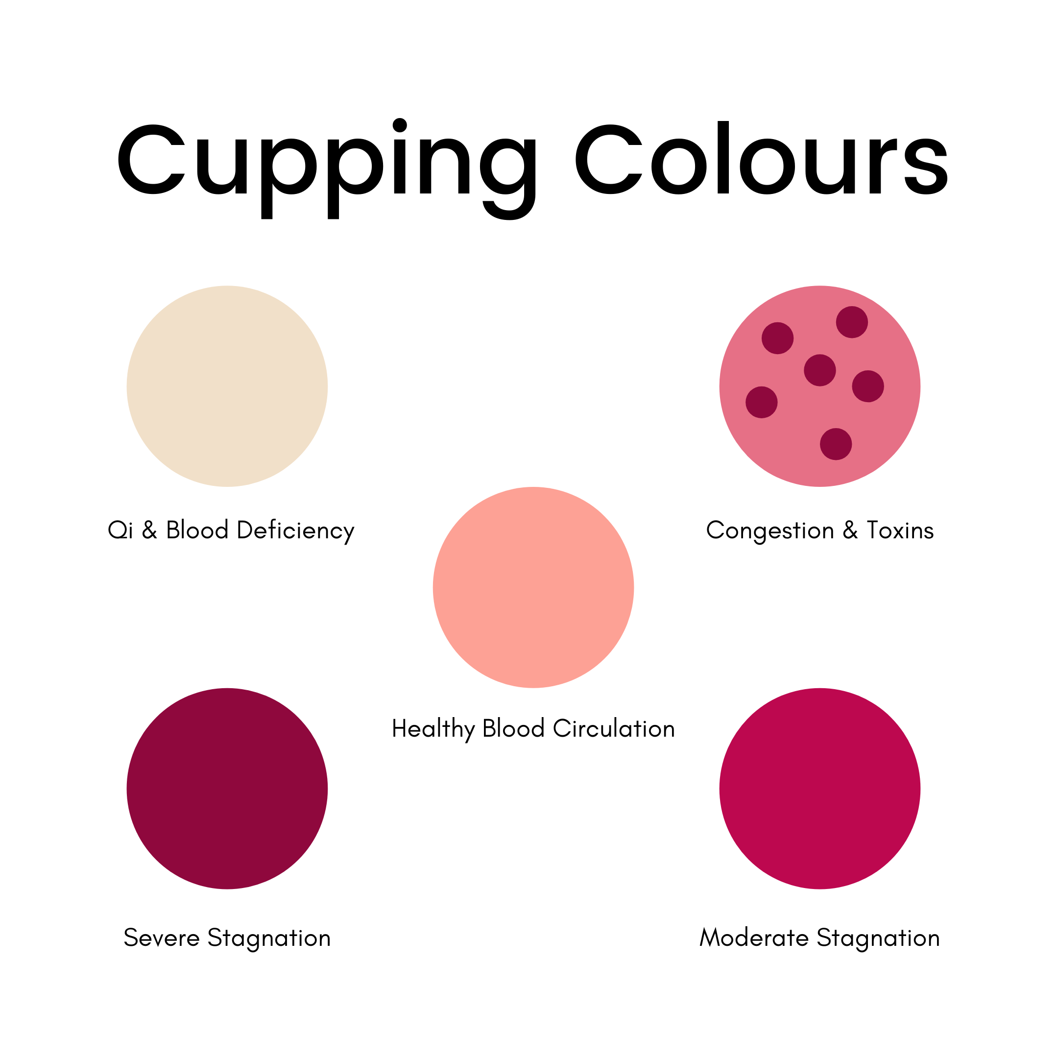 Cupping Therapy Color Chart Understanding Cupping Marks VSIRB